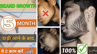 BEARD GROWTH  5 MONTHS DONE ✔️ दाढ़ी आने के बाद ये 2 काम जरुर करें  Beard journey successful [upl. by Notnirt]