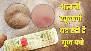 okacet tablet review in hindi ओकासेट टैबलेट उपयोग इन समस्या में करे एलर्जिक खूजली कॉमन कोल्ड okacet [upl. by Mccord]