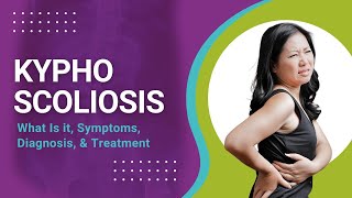 Kyphoscoliosis What Is it Symptoms Diagnosis amp Treatment [upl. by Goss359]