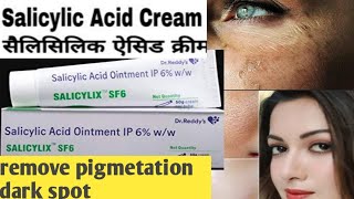 salicylic Acid Cream Salicylic Acid Ointment IP 6 Review In Hindi  Remove Pigmentation Acne scars [upl. by Audra276]