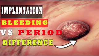 Implantation Bleeding Vs Period – How to Know the Difference 🩸🩸 [upl. by Virgina]