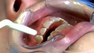 The Doctors Dr Bill Dorfman Transforms Severe Tooth Deterioration [upl. by Winograd980]