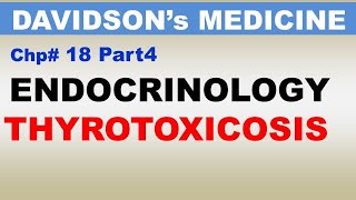 Davidsons Medicine Chp18 Part4  Endocrinology  THYROTOXICOSIS  Dr Asif Lectures [upl. by Lorine]