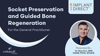 Dental Treatment Socket Preservation and Guided Bone Regeneration for GPs  Sep 28 2023 [upl. by Teri]