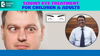 Best Treatment for SquintCrossed Eye How can I fix SQUINT EyeDrSriram RamalingamDoctors Circle [upl. by Epolulot]