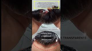 Prótesis Capilar frontal para Hombre  Cabello humano protesiscapilares [upl. by Savannah]