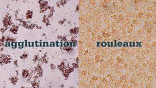 How to Perform a Saline Agglutination Test [upl. by Gareth74]