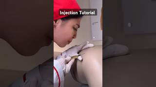 Injection Tutorial tutorial injection shorts littos [upl. by Burck]