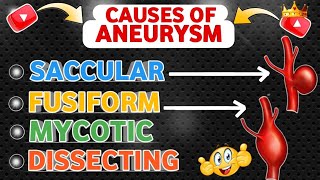 Understanding  Causes Of Aneurysm 😍 [upl. by Einnij]