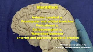 Anterior cerebral artery Medial surface of hemisphere neuroanatomy arteries medicalstudent [upl. by Ailegave]