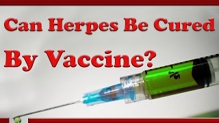 Herpes Cure News Vaccine Breakthrough 2017 [upl. by Boatwright29]