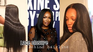 DIY Lace closure behind hairline wig [upl. by Dixon]