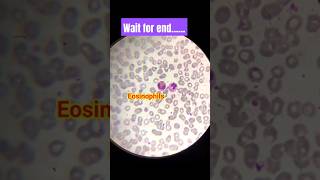 Microscopic examination of blood smear  shorts trendingshorts viral dmlt bloodtest lab [upl. by Shirleen]