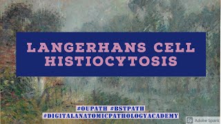 Langerhans Cell Histiocytosis [upl. by Kenny521]