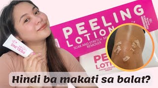 ROSMAR KAGAYAKU PEELING LOTION 10X INSTANT WHITENING HONEST REVIEW CRISTINE SIANGCUA [upl. by Hsitirb247]