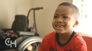 First Bilateral Hand Transplant in a Child Zions Story [upl. by Iveksarap464]