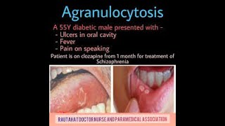 Agranulocytosis Symptoms and Causes  Diagnosis  Treatment  Prevention [upl. by Mikes486]