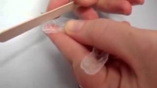 How to Trim Essix Retainers [upl. by Heyman]