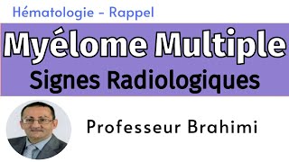 Myélome Multiple Signes Radiologiques [upl. by Enutrof]