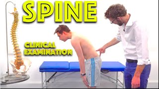 Spine Examination  Back Pain Assessment  4K  Clinical Skills  Dr Gill [upl. by Eirrej]