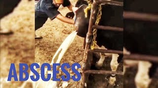 BEST ABSCESS COMPILATION [upl. by Ardnaz]