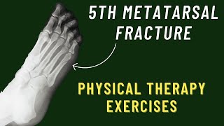 5th Metatarsal Fracture Exercises  Jones Fracture Rehab Exercises  Foot Fracture Physical Therapy [upl. by Nailil]