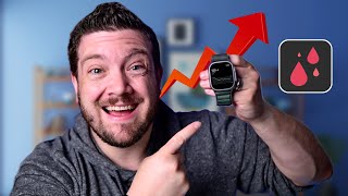 Apple Watch FINALLY Got a Glucose Monitor [upl. by Ednalrim]