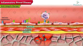 Inflammatory Bowel Disease Pharmacology Lectures [upl. by Ianaj103]