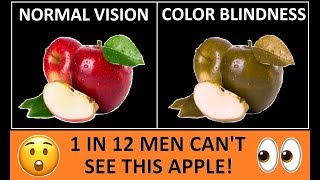 Types of Color Blindness  Color Vision Deficiency [upl. by Hofmann]