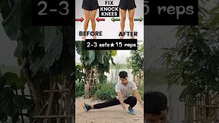 How to fix KNOCK knees problem✅⁉️ exercise knockknees shorts trending army ytshorts [upl. by Karen]