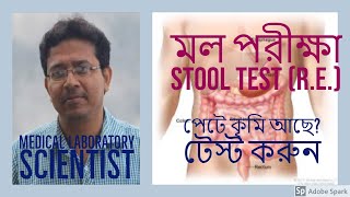 মল পরীক্ষা Stool Test Stool Analysisপায়খানা পরীক্ষা Mol Pariksha [upl. by Yentnuoc]