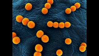 Enterococcus faecalis [upl. by Atiran]