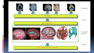 89 Neuronavigation and Intraoperative Imaging [upl. by Tomi]