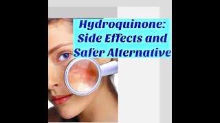 DANGERS of treating Pigmentation with HYDROQUINONEHere it is an alternative [upl. by Doloritas]