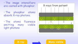 Medical Imaging 03  X ray Image Intensifiers [upl. by Foley]