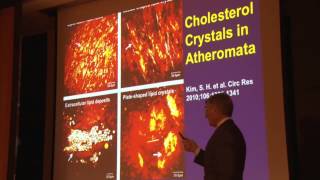 Inflammation in Atherosclerosis Peter Libby [upl. by Wende]