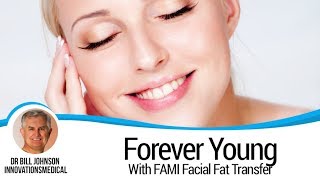 FAMI  Facial Fat Transfer  Dr Bill Johnson [upl. by Lednik]