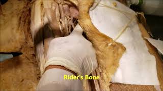 Medial Thigh Muscles – Hip Adductors HD Video – Sanjoy Sanyal [upl. by Tamara]