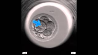 EmbryoScope Embryo Development  Large fragment looks like blastomere [upl. by Ameen]