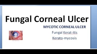 Ophthalmology 115 a Fungal Corneal Ulcer Mycotic Keratitis KeratoMycosis Eye treatment fungus anti [upl. by Leila]