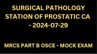 SURGICAL PATHOLOGY STATION OF PROSTATIC CA [upl. by Arodaeht]