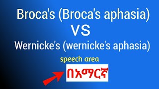 Brocas aphasia vs Wernickes aphasia Brocas vs Wernickes speech area in amharic በአማርኛ [upl. by Nairbo]