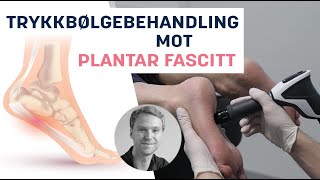 Effektiv Trykkbølgebehandling mot Plantar Fascitt [upl. by Haisi477]