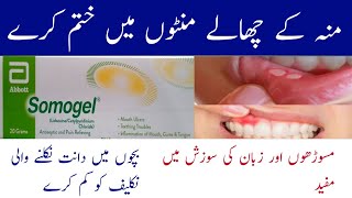 somogel for mouth ulcers  somogel  sumo gel  somogel lagane ka tarika  mouth ulcer treatment [upl. by Marybeth]