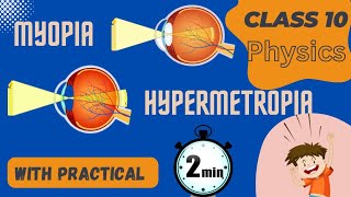 Myopia amp Hypermetropia II Reason II Correction  Practical [upl. by Tchao]