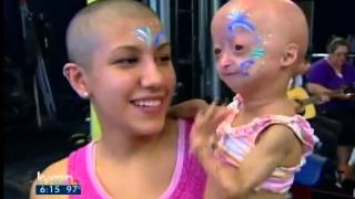 Adalia Rose holds fundraiser for Progeria [upl. by Elidad153]