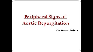 Peripheral signs of Aortic Regurgitation Dr Sameena Farheen [upl. by Wane]