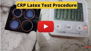 CReactive Protein Test CRP Latex Test Procedure [upl. by Nylia422]