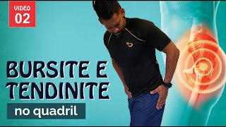 Bursite e Tendinite no quadril  VIDEO  02  Mobilidade Articular e Fortalecimento do quadril [upl. by Yhtomot]