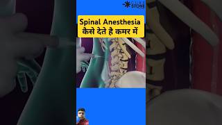 Spinal Anesthesia kaise dete hai anesthisa mbbs knowledge science shorts [upl. by Neerroc]